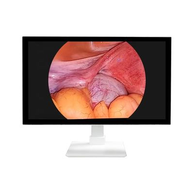 comprare TUYOU Sistema di telecamera per endoscopia rigida All-in-One 4K 32'' per uso medico con sorgente luminosa a LED per otorinolaringoiatria e laparoscopia fabbricazione online