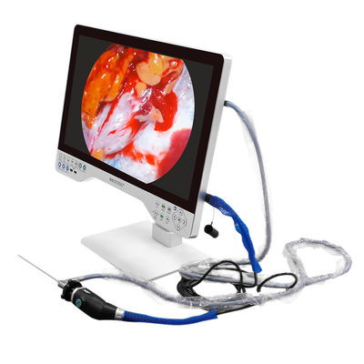 comprare Telecamera elettrica per l'endoscopia medica a monitor 4K con fonte luminosa integrata e registrazione USB fabbricazione online