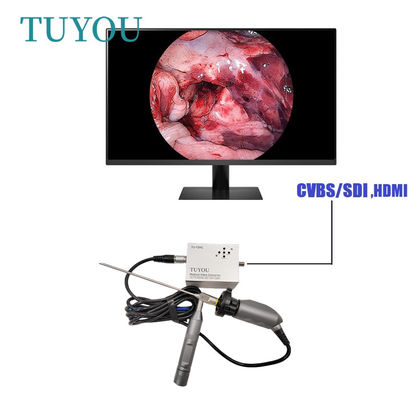 comprare Full HD Telecamera medica portatile elettrica ENT Endoscope per computer portatile fabbricazione online