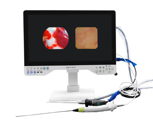 comprare TUYOU Telecamera endoscopica Full HD con sensore CMOS SONY 1/2.8