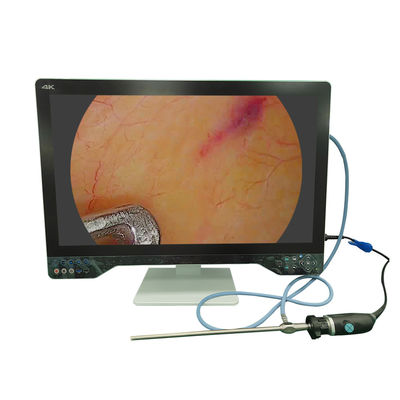 comprare Sistema di telecamera per endoscopia medica 4K da 32