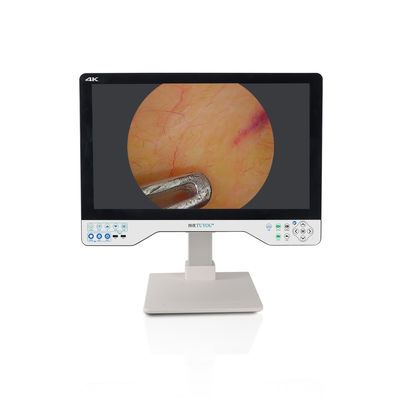 comprare 24 pollici monitor laparoscopico 4K UHD Endoscope Camera Sistema LED chirurgica con sorgente luminosa fabbricazione online
