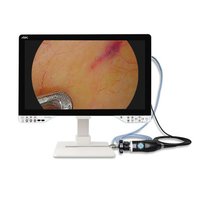 comprare Endoscopio da 27 pollici 4K per chirurgia laparoscopica con sorgente luminosa e monitor fabbricazione online