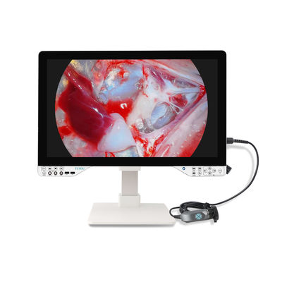 comprare Sistema di telecamera per endoscopia FHD da 27