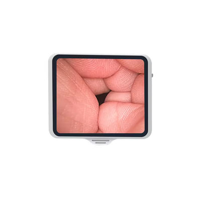 comprare Endoscopio flessibile di classe I TUYOU con schermo da 3,5 pollici riutilizzabile per lo zoom della broncoscopia in fibra ottica fabbricazione online