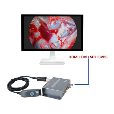 comprare Fabbricazione TUYOU Fotocamera integrata portatile 1080P per l' endoscopia medica per la chirurgia nasale e animale domestico fabbricazione online