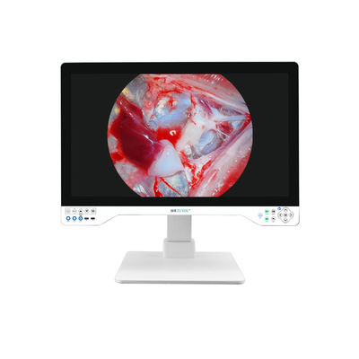 comprare Fotocamera di endoscopia 4K avanzata da 32