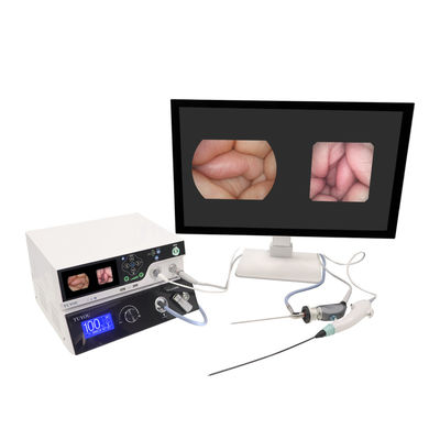 comprare TUYOU Manufacturer 1080P Imaging Equipment With Rigid And Flexible Endoscopy Camera System per le ENT fabbricazione online