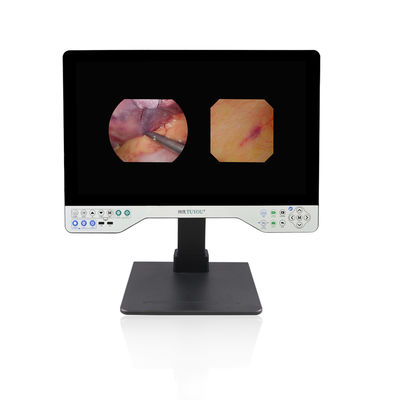 comprare OEM/ODM Factory Direct 24-Inch All-in-One Camera System with Rigid & Flexible Endoscope for ENT and Urological Surgery fabbricazione online
