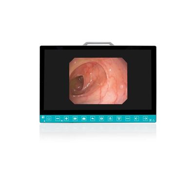 comprare TUYOU 13,3 pollici FHD Flessibile Endoscopio Camera Sistema Multi-Colore OEM Custom All-in-One Portatile Uro-Gyn TikTok Hit fabbricazione online