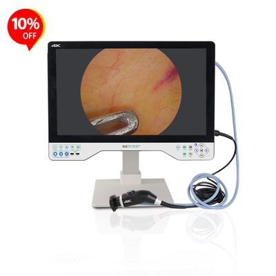 comprare All-in-one Camera System With 24 Inches Monitor For Laparoscopy ENT Surgery Manufacturer  fabbricazione online
