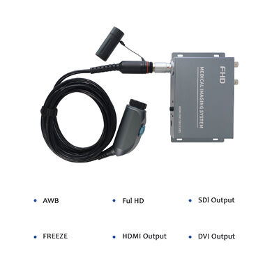 comprare Wireless Portable Endoscope Camera System - High Resolution for ENT/Orthopedics Clinical Examination fabbricazione online