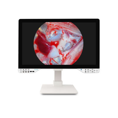 comprare Fotocamera endoscopica TUYOU di grado medico da 27 pollici - FHD/4K per procedure laparoscopiche ENT fabbricazione online