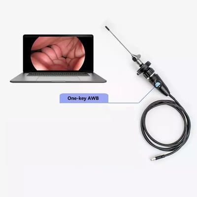 Telecamera endoscopica USB portatile elettrica Full HD CMOS per la ginecologia