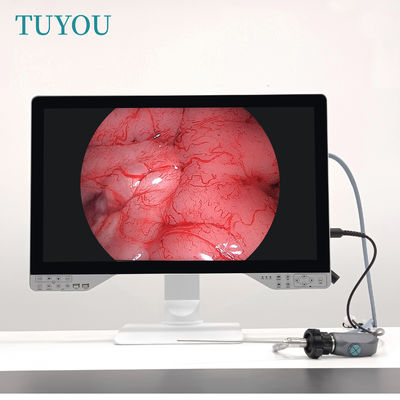 Disco U 27 pollici 1080P Full HD 4 in 1 Artroscopio medico Sistema isteroscopio Endoscopio Camera