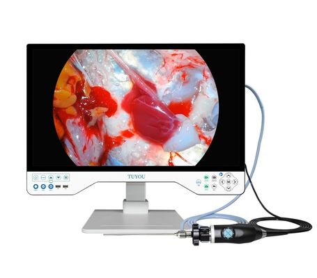 Sistema di telecamere per endoscopia HD con sorgente luminosa da 80 W e garanzia di 3 anni