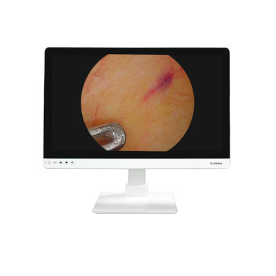 4K FHD attrezzature mediche 27 pollici Endoscope Camera Monitor Display Per Endoscope