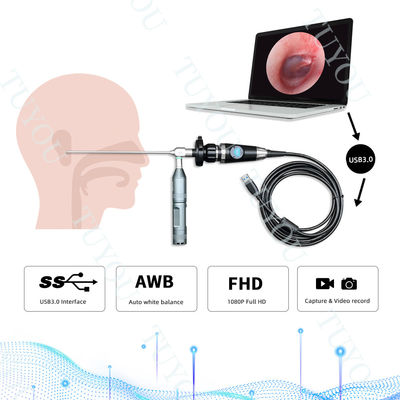 Fotocamera portatile USB3.0 per l'endoscopia per l'ispezione medica ENT