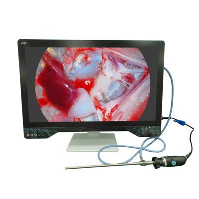 Fotocamera endoscopica ad alta definizione 4K per la laparoscopia con monitor e sorgente luminosa da 32 pollici