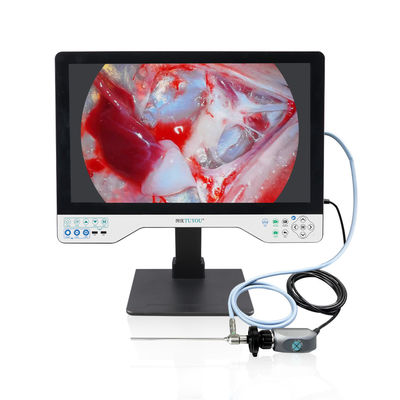 Factory Direct 24' All-in-One HD Endoscope Camera System per ENT, Urologia e Laparoscopia endoscopia