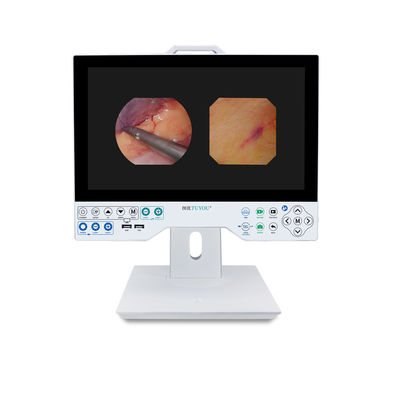 15.6/24/27/32 pollici TUYOU All in One Endoscope Camera per Laparoscopia Chirurgia