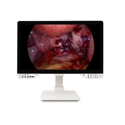 27 pollici FHD 1080P Endoscopic Camera System Solo Endoscopio rigido con monitor e potenza ottica efficace di 100W