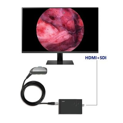 Fotocamera video portatile di endoscopia TUYOU Full HD 1920x1080 Risoluzione 120 gradi Campo visivo per urologia spina dorsale e chirurgia ENT