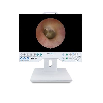 Disegno di fabbrica Sistema di telecamere FHD da 15 pollici con endoscopio flessibile e rigido compatibile con i record