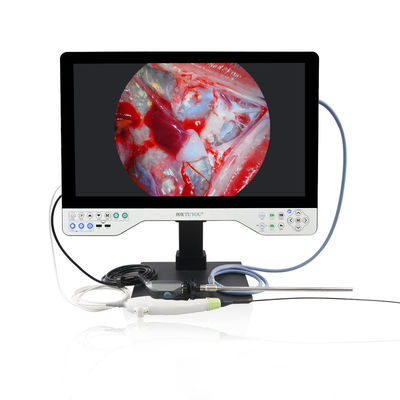 Sistema di telecamere 4K All In One Endoscope Luce LED integrata e campo flessibile per la laparoscopia