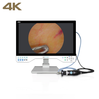 Sistema di telecamera per endoscopia FHD All-in-One TUYOU con monitor chirurgico da 24