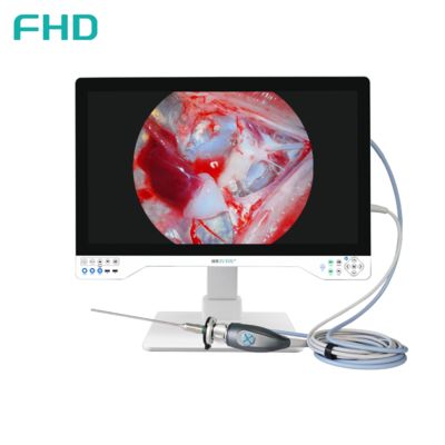 Sistema di telecamera per endoscopia FHD All-in-One TUYOU con monitor chirurgico da 32 pollici per procedure ORL e urologiche