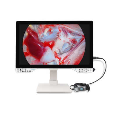 Sistema di telecamera per endoscopia FHD da 27 pollici con luce LED da 100 W per chirurgia ORL