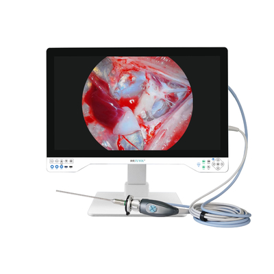 Sistema di telecamere 4K All In One Endoscope Luce LED integrata con monitor medico da 32 pollici