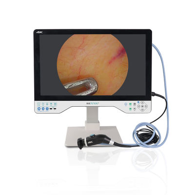 Fotocamera endoscopica TUYOU da 24 pollici 1080P con IPX8 impermeabile 8 ore di durata della batteria e 2 anni di garanzia per l'endoscopia medica