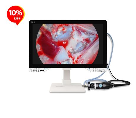 Sistema di telecamere endoscopiche tutto in uno da 27 pollici con potenza ottica efficace di 100 W per chirurgia ENT e urologia laparoscopica