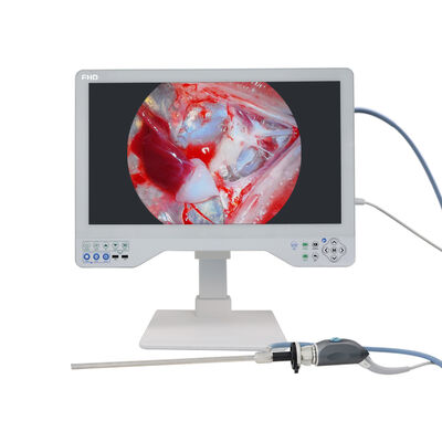 Sistema di telecamera per endoscopio All-in-One da 24 pollici - Immagini HD per procedure chirurgiche ORL laparoscopiche