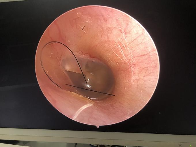 Monitor LCD portatile tutto in un HD Endoscopia Fotocamera per ENT Laparoscopia Isteroscopia Urologia 2